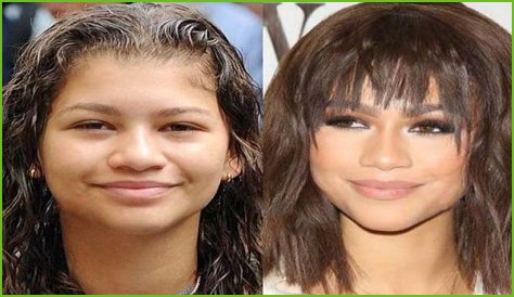 Unveiling The Secrets Of Zendaya's Nose Job: Discoveries And Insights