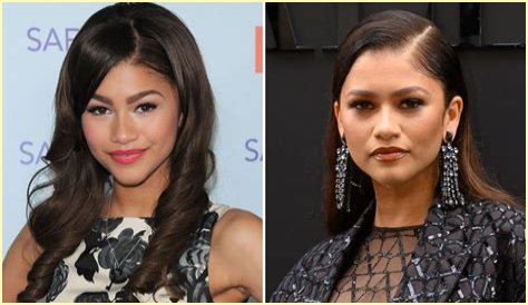 Unveiling The Truth: Zendaya's Plastic Surgery Journey